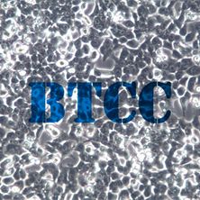 HCT-116人结直肠腺癌细胞