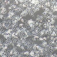 HCT-8/5FU 结直肠癌氟尿嘧啶耐药株 STR鉴定