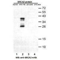 BRCA2 (1475-1748)