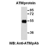 ATM Polyclonal Antibody