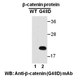 β-catenin (G48D)