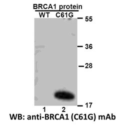 BRCA1 (C61G)