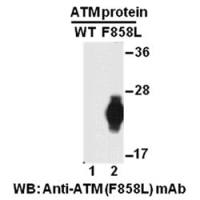 ATM(F858L)