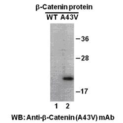 β-catenin(A43V)