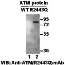 ATM(R2443Q)