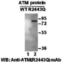 ATM(R2443Q)