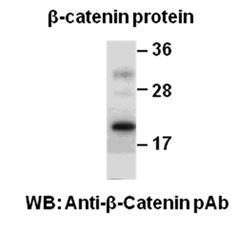 β-Catenin Polyclonal Antibody