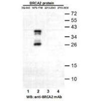 BRCA2 (1475-1748)