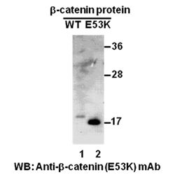 β-catenin (E53K)