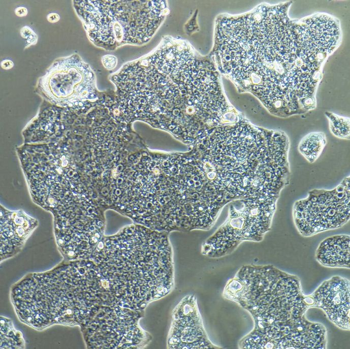 NCI-N87 人胃癌细胞 STR鉴定 镜像绮点（Cellverse）