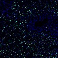 TUN EL检测细胞凋亡