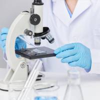 iTRAQ定量蛋白质组学