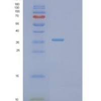 人PTEN诱导假定激酶1(PINK1)重组蛋白