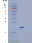 人前折叠蛋白亚基2(PFDN2)重组蛋白