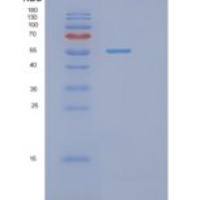 大肠杆菌phrB重组蛋白