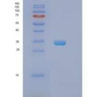 人阻抑素(PHB)重组蛋白