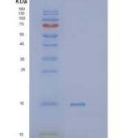 人催乳素诱导蛋白(PIP)重组蛋白