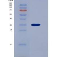 人嘌呤核苷磷酸化酶(PNP)重组蛋白