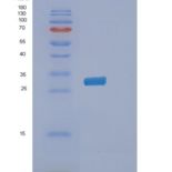 人磷脂酰肌醇转运蛋白β(PITPNb)重组蛋白