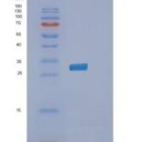 人磷脂酰肌醇转运蛋白β(PITPNb)重组蛋白
