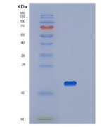 人血小板受体Gi24重组蛋白