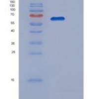 人葡萄糖磷酸变位酶1(PGM1)重组蛋白