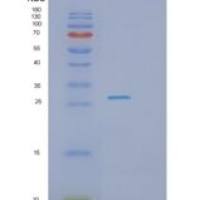 人PHOSPHO2重组蛋白
