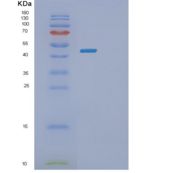 人PLA2G7重组蛋白