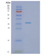 人PTEN诱导假定激酶1(PINK1)重组蛋白