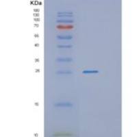 人PGPEP1重组蛋白