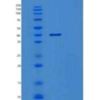 人DNA指导聚合酶β(POLb)重组蛋白