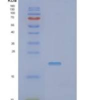 小鼠肽基脯氨酰顺反式异构酶NIMA相互作用蛋白1(PIN1)重组蛋白