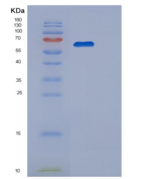 人葡萄糖磷酸变位酶1(PGM1)重组蛋白