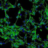 NCI-H1838细胞NCI-H1838细胞株NCI-H1838肺腺癌细胞