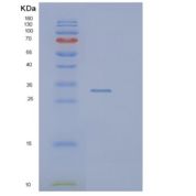 人Pim-1原癌基因(PIM1)重组蛋白