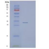 人Pim-1原癌基因(PIM1)重组蛋白