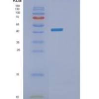 人PKCK2重组蛋白