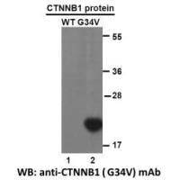 CTNNB1(G34V)