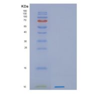 人蛋白激酶抑制因子β(PKIb)重组蛋白