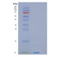 人蛋白激酶抑制因子β(PKIb)重组蛋白