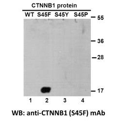 CTNNB1(S45F)