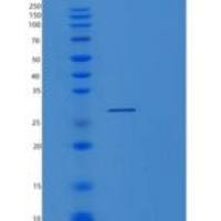 人核糖核酸酶P蛋白亚单位p29（pop 4）重组蛋白