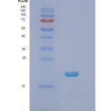 人普列克底物蛋白同源物样域家族A成员2(PHLDA2)重组蛋白