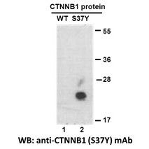 CTNNB1(S37Y)