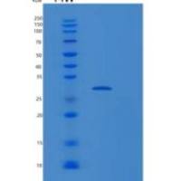 人磷酸甘油酸变位酶2(PGAM2)重组蛋白