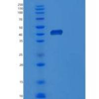 人DNA指导的RNA聚合酶I和III亚单位RPA C1（POLR1C）重组蛋白