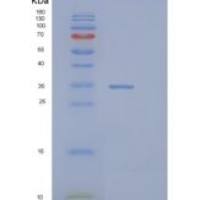 人PIH1D1重组蛋白