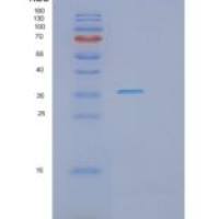 人PHF13重组蛋白