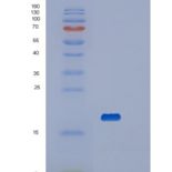 人血小板受体Gi24重组蛋白