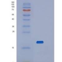 人血小板受体Gi24重组蛋白